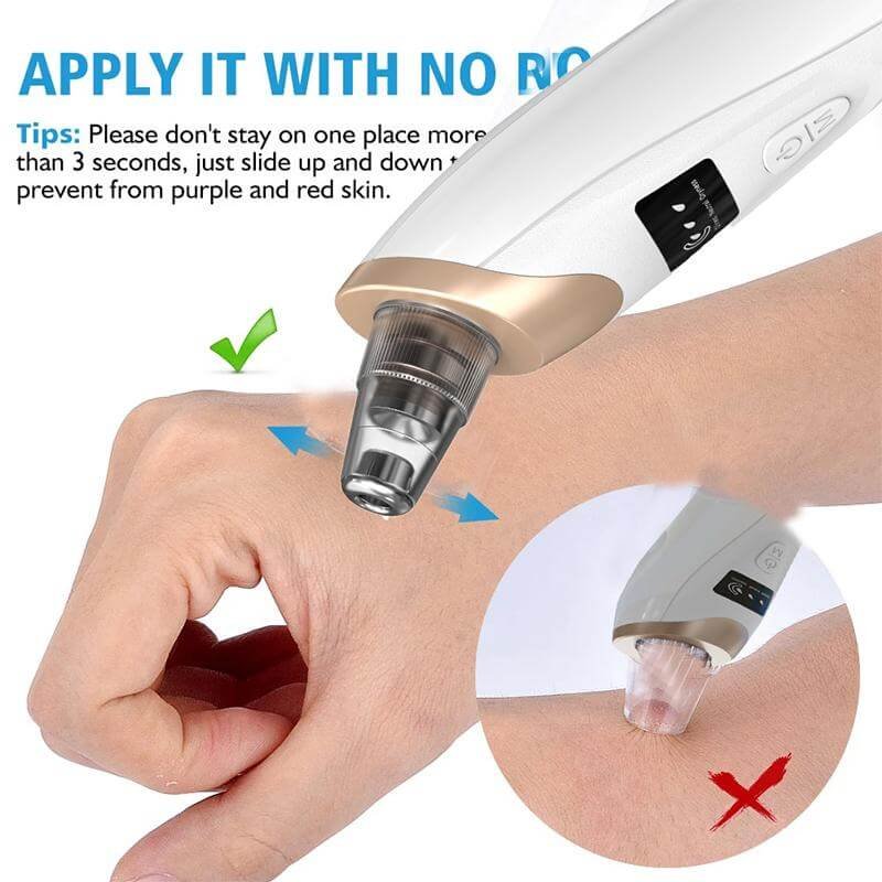 5 in 1 Electric Blackhead Remover Vacuum suction Face Pore Cleanser Facial beauty