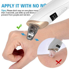 Load image into Gallery viewer, 5 in 1 Electric Blackhead Remover Vacuum suction Face Pore Cleanser Facial beauty