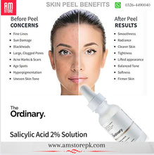 Load image into Gallery viewer, The Ordinary SALICYLIC ACID 2% SOLUTION
