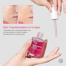 Load image into Gallery viewer, Anua Niacinamide 10% + TXA 4% Dark Spot Correcting Serum Korea