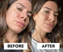 Load image into Gallery viewer, CeraVe Blemish Control Gel Moisturiser with 2% Salicylic Acid &amp; Niacinamide for Blemish-Prone Skin 40ml