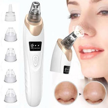 Load image into Gallery viewer, Blackhead Remover Machine